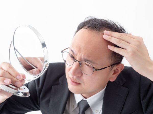 薄毛を気にする男性