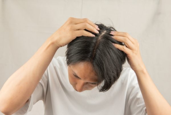 薄毛を気にする男性